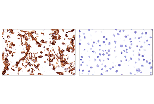 Immunohistochemistry Image 6: CD248 (E9Z7O) XP<sup>®</sup> Rabbit mAb