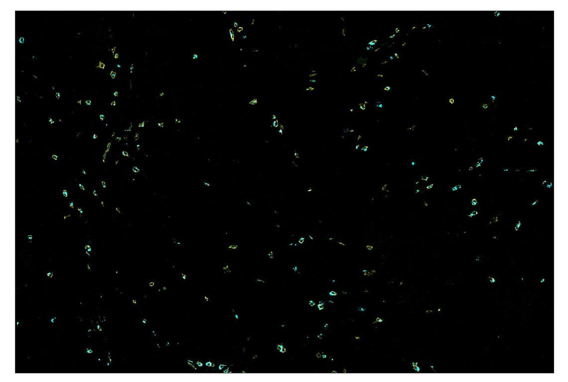 Immunohistochemistry Image 7: CD8α (D8A8Y) & CO-0004-647 SignalStar<sup>™</sup> Oligo-Antibody Pair
