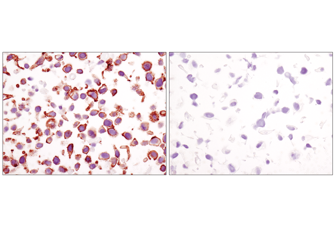 undefined Image 48: Cadherin-Catenin Antibody Sampler Kit