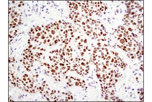 Immunohistochemistry Image 2: HES1 (D6P2U) Rabbit mAb
