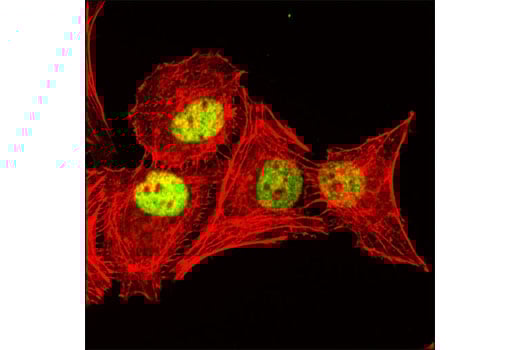 Immunofluorescence Image 1: STAG2 (D25A4) XP<sup>®</sup> Rabbit mAb