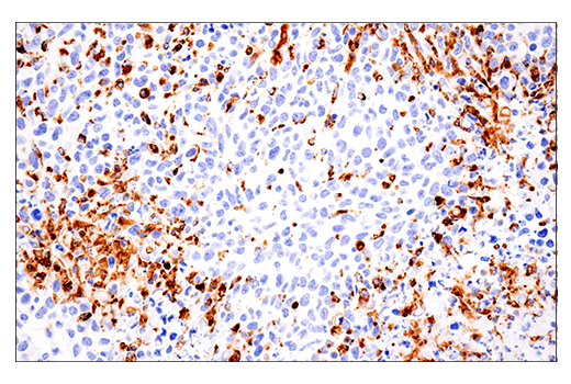 Immunohistochemistry Image 2: CD68 (E3O7V) Rabbit mAb