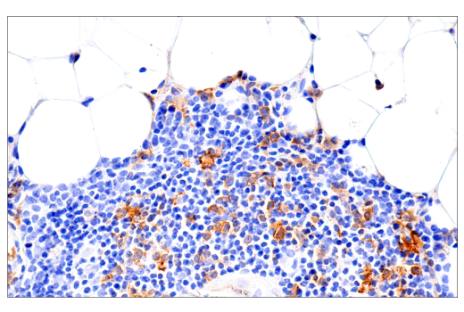Immunohistochemistry Image 6: GM-CSF Receptor α (E8Z3S) Rabbit mAb