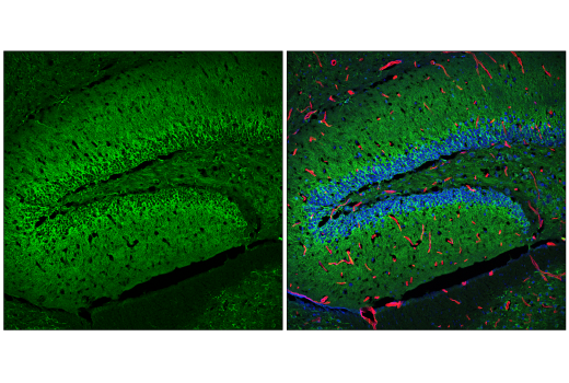Immunofluorescence Image 1: CaMKII-γ (E4C3O) Rabbit mAb