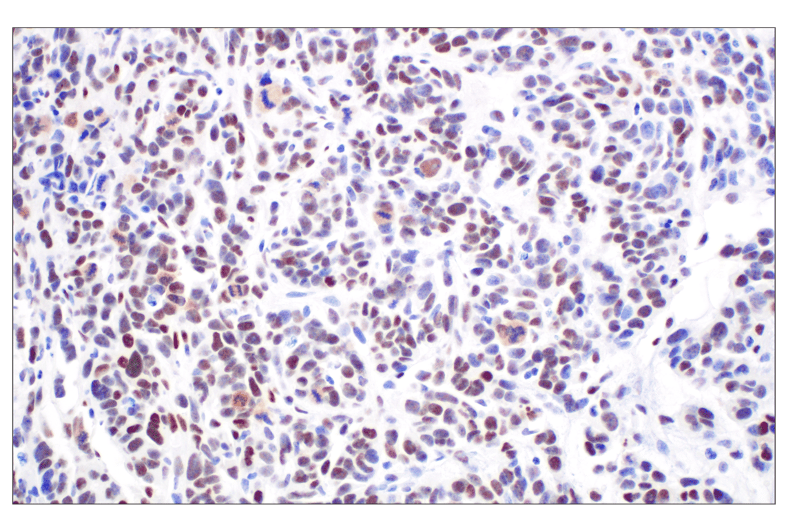 Immunohistochemistry Image 3: TCF4/ITF2 (E3X2Y) Rabbit mAb