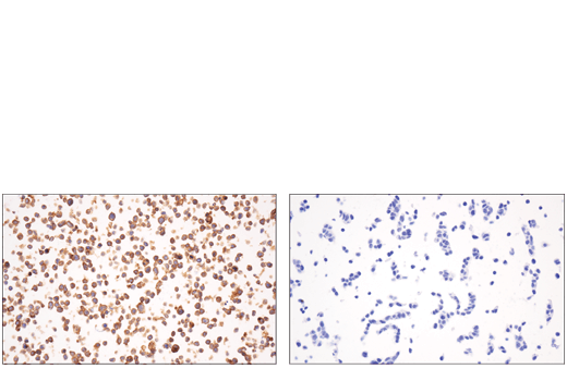 Immunohistochemistry Image 6: CD48 (D7L8I) XP<sup>®</sup> Rabbit mAb (BSA and Azide Free)