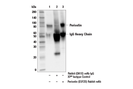 undefined Image 3: Extracellular Matrix Dynamics Antibody Sampler Kit