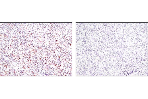 Immunohistochemistry Image 2: Phospho-Stat1 (Ser727) (D3B7) Rabbit mAb