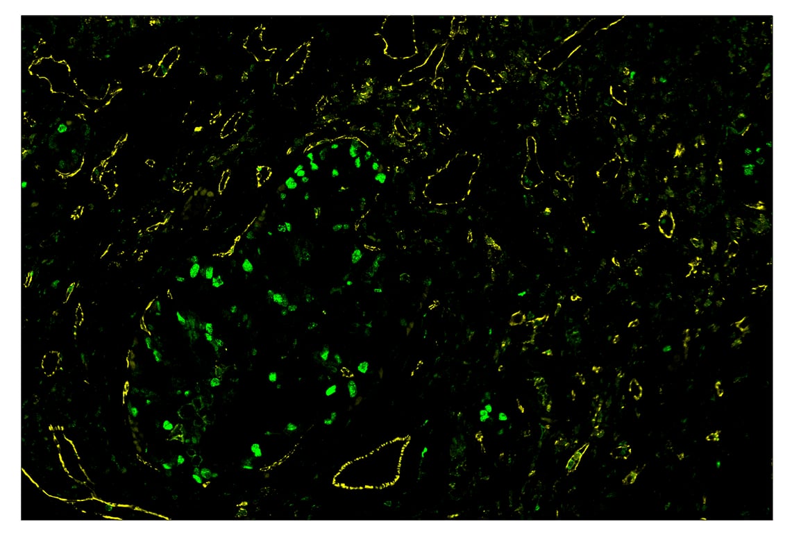 Immunohistochemistry Image 1: CD31 (PECAM-1) (89C2) & CO-0028-750 SignalStar<sup>™</sup> Oligo-Antibody Pair