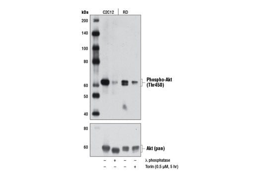 Western Blotting Image 2: Phospho-Akt (Thr450) (D5G4) Rabbit mAb