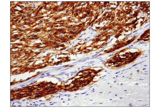 Immunohistochemistry Image 2: c-Kit (D3W6Y) XP<sup>®</sup> Rabbit mAb (BSA and Azide Free)