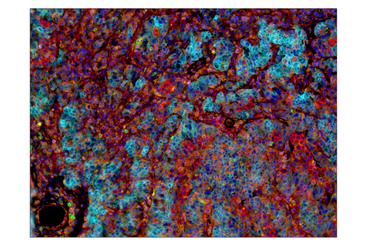 Immunohistochemistry Image 5: LAG3 (D2G4O<sup>™</sup>) XP<sup>®</sup> Rabbit mAb (BSA and Azide Free)