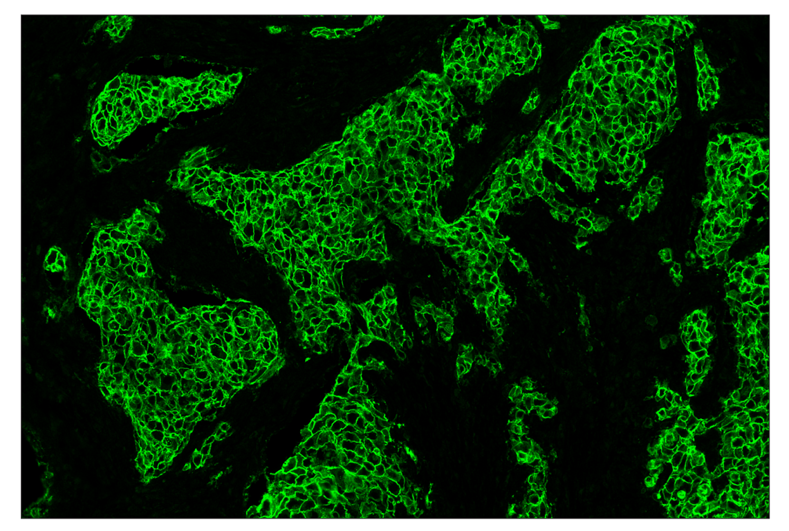Immunohistochemistry Image 2: HER2/ErbB2 (D8F12) & CO-0059-488 SignalStar<sup>™</sup> Oligo-Antibody Pair