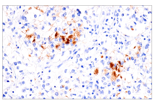 Immunohistochemistry Image 2: Fibrinogen gamma chain (E1U3Z) XP<sup>®</sup> Rabbit mAb (BSA and Azide Free)