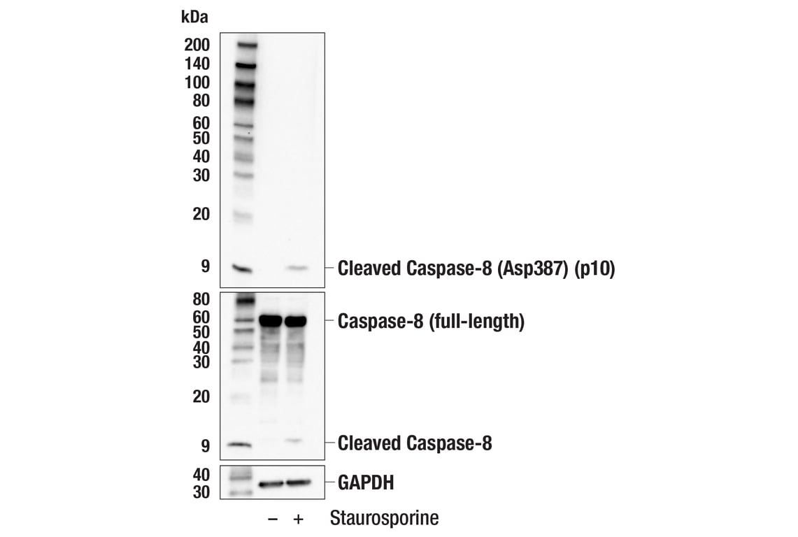 Western Blotting Image 2: Cleaved Caspase-8 (Asp387) (p10 subunit) (E8K5S) Rabbit mAb