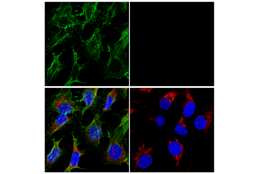 Immunofluorescence Image 1: β-Catenin (D10A8) XP<sup>®</sup> Rabbit mAb (Alexa Fluor<sup>®</sup> 488 Conjugate)