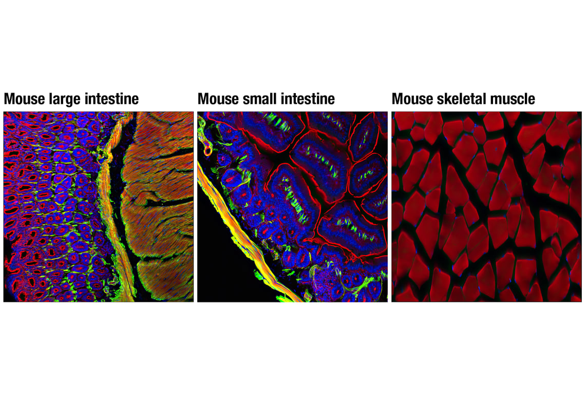 Immunofluorescence Image 1: α-Smooth Muscle Actin (D4K9N) XP<sup>®</sup> Rabbit mAb (Alexa Fluor<sup>®</sup> 488 Conjugate)