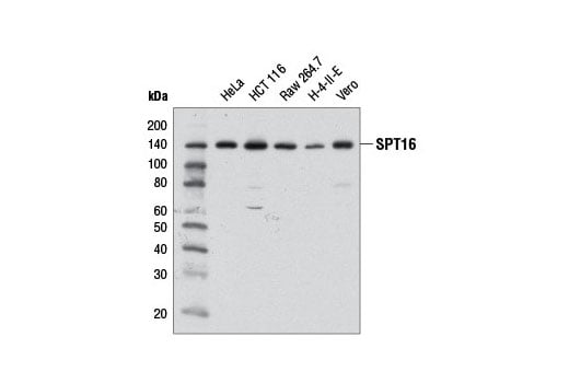 Western Blotting Image 1: SPT16 (D7I2K) Rabbit mAb