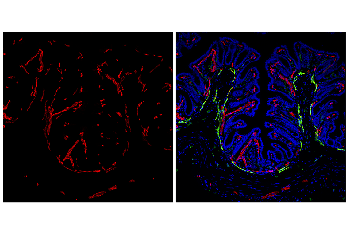 Immunofluorescence Image 1: CD31 (PECAM-1) (F2N3M) Rabbit mAb (Alexa Fluor® 555 Conjugate)