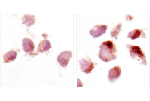 Immunohistochemistry Image 3: LC3A (D50G8) XP<sup>®</sup> Rabbit mAb