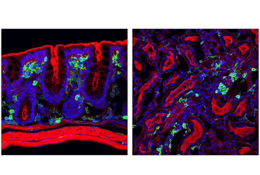 Immunofluorescence Image 3: CD45 (D3F8Q) Rabbit mAb