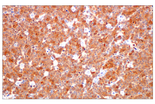 Immunohistochemistry Image 6: p16 INK4A (BC42) Mouse mAb