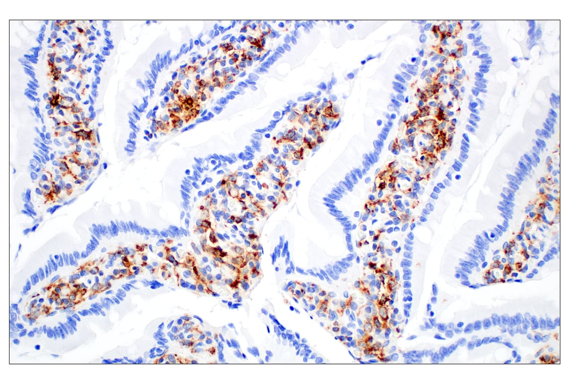 Immunohistochemistry Image 5: CD68 (E3O7V) Rabbit mAb