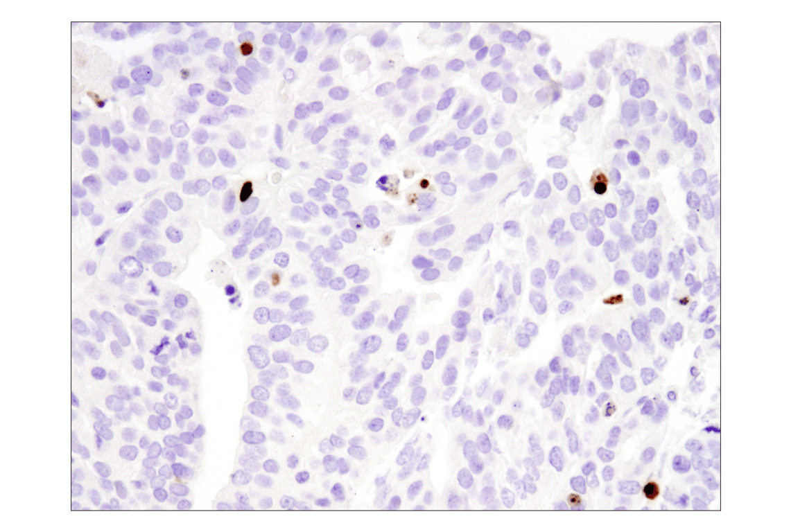 undefined Image 28: Apoptosis Antibody Sampler Kit II