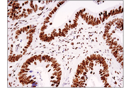 Immunohistochemistry Image 2: Tri-Methyl-Histone H3 (Lys36) (D5A7) XP<sup>®</sup> Rabbit mAb