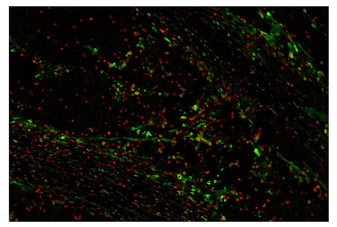 Immunohistochemistry Image 2: OX40 (E9U7O) & CO-0086-594 SignalStar<sup>™</sup> Oligo-Antibody Pair