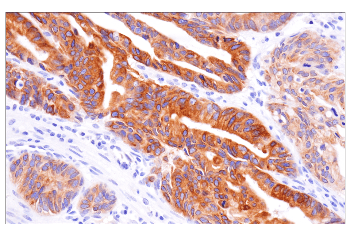 Immunohistochemistry Image 2: KK-LC-1 (F3U6C) Rabbit mAb