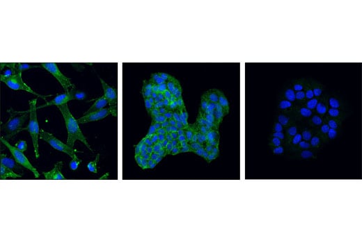 Immunofluorescence Image 1: Mer (D21F11) XP<sup>®</sup> Rabbit mAb