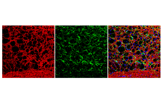 Immunofluorescence Image 1: Anti-mouse IgG (H+L), F(ab')<sub>2</sub> Fragment (Alexa Fluor® 555 Conjugate)