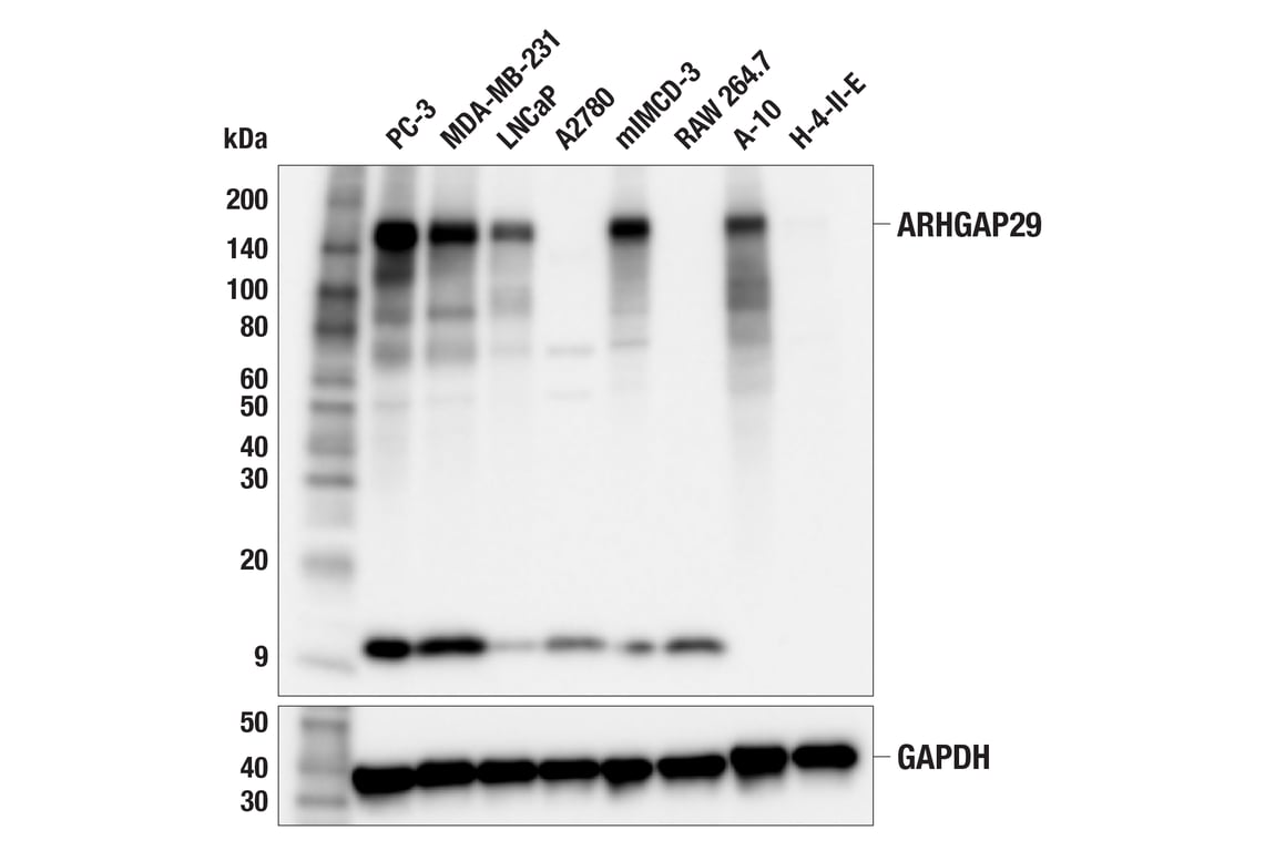 Western Blotting Image 1: ARHGAP29 (F6O5B) Rabbit mAb