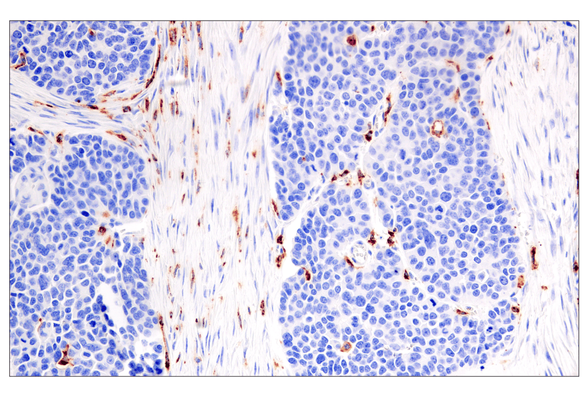 Immunohistochemistry Image 3: HLA-DRA (E9R2Q) XP<sup>®</sup> Rabbit mAb