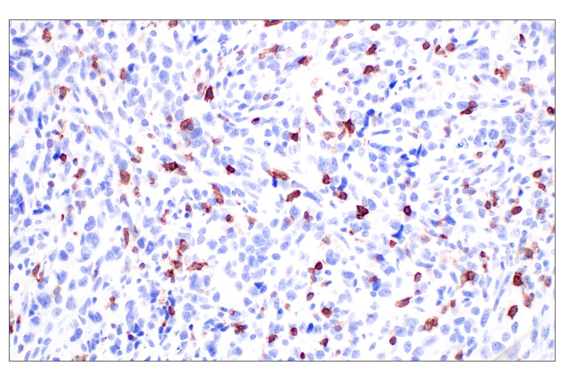 Immunohistochemistry Image 3: CD5 (E6N9S) Rabbit mAb