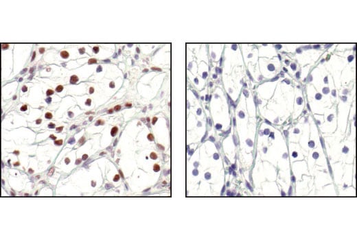 undefined Image 66: Cannabinoid Receptor 1 Downstream Signaling Antibody Sampler Kit
