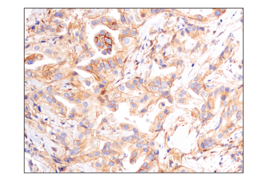 Immunohistochemistry Image 2: Notch2 (D76A6) XP<sup>®</sup> Rabbit mAb (BSA and Azide Free)