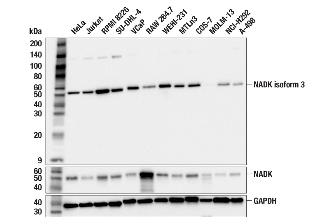 Western Blotting Image 1: NADK Isoform 3 (F5E2T) Rabbit mAb