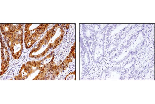 Immunohistochemistry Image 1: Phospho-YAP (Ser127) (D9W2I) Rabbit mAb