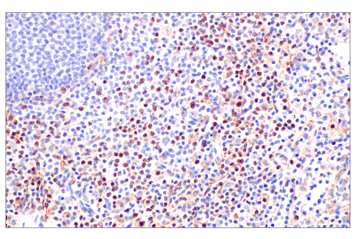 Immunohistochemistry Image 5: VISTA (D1L2G<sup>™</sup>) XP<sup>®</sup> Rabbit mAb