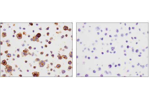 Immunohistochemistry Image 3: 4-1BB/CD137/TNFRSF9 (D2Z4Y) Rabbit mAb