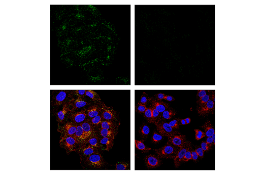 Immunofluorescence Image 1: APP (E5X2B) Rabbit mAb