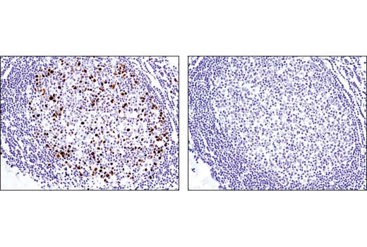 Immunohistochemistry Image 3: Topoisomerase IIα (D10G9) XP<sup>®</sup> Rabbit mAb