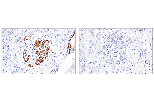 Immunohistochemistry Image 3: Sox10 (E6B6I) XP<sup>®</sup> Rabbit mAb (BSA and Azide Free)