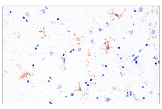 Immunohistochemistry Image 2: GM-CSF Receptor α (E8Z3S) Rabbit mAb
