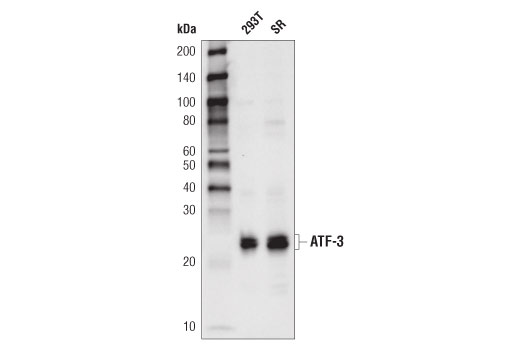 Western Blotting Image 1: ATF-3 (D2Y5W) Rabbit mAb