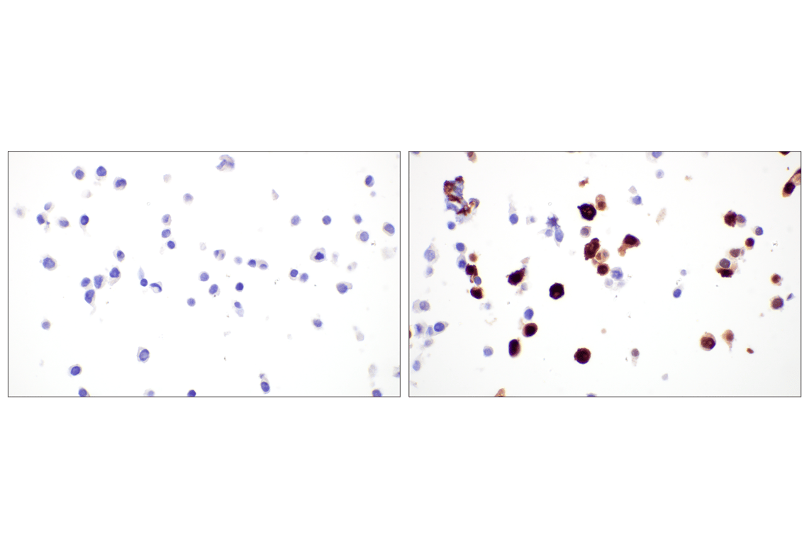 Immunohistochemistry Image 1: T-bet/TBX21 (E4I2K) Rabbit mAb