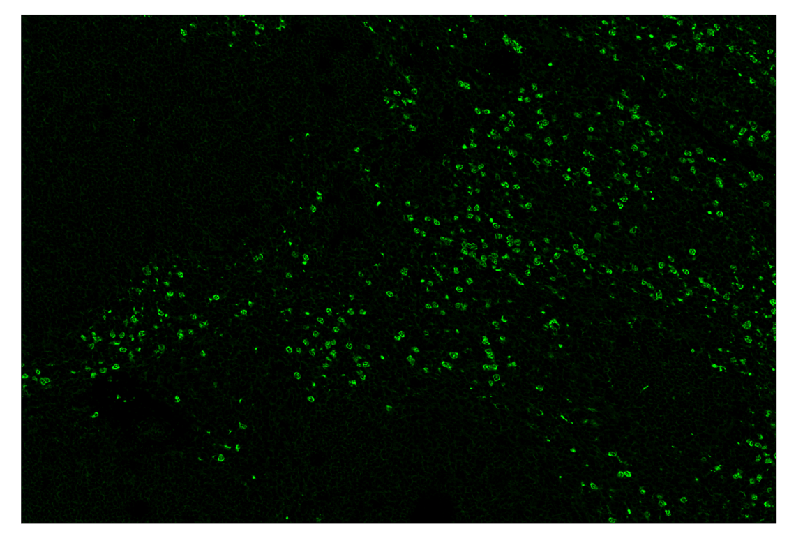 Immunohistochemistry Image 2: Ly-6G (E6Z1T) & CO-0053-647 SignalStar<sup>™</sup> Oligo-Antibody Pair