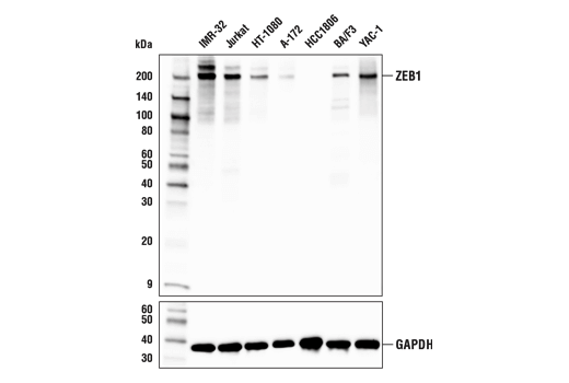 Western Blotting Image 1: ZEB1 (E2G6Y) XP<sup>®</sup> Rabbit mAb (BSA and Azide Free)